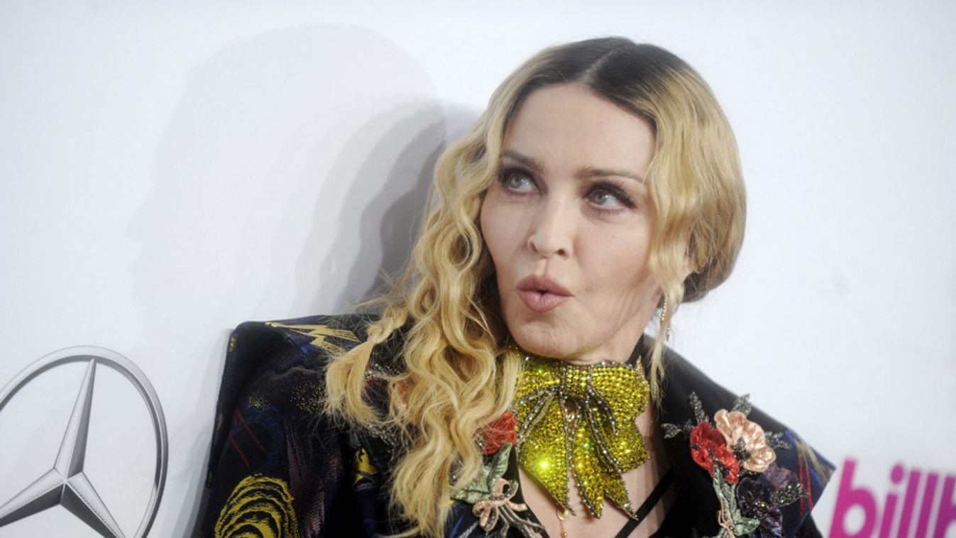 Mi történt Madonna arcával? Új fotóin rá sem lehet ismerni
