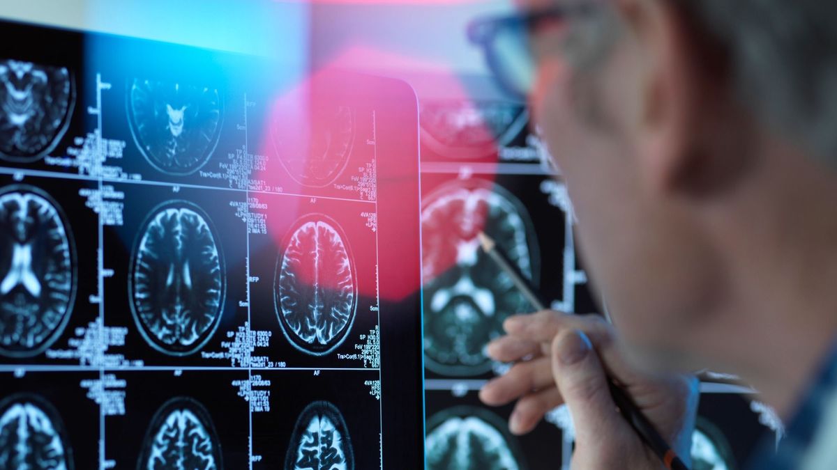 Így előzhető meg a retteget kór: titkok a kaposvári Alzheimer Café alapítóitól